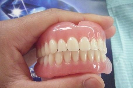 什么是牙槽骨突出